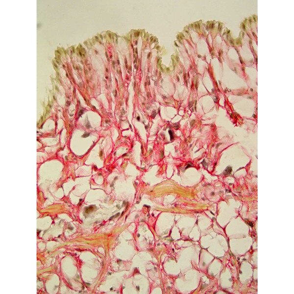 Weigert's Hematoxylin Solution B